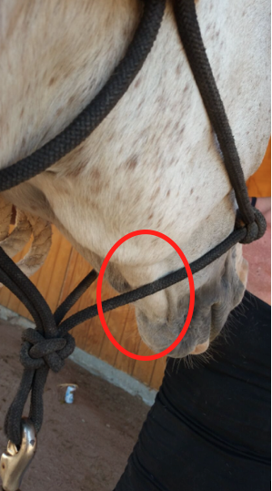 Swelling of Lower Jaw